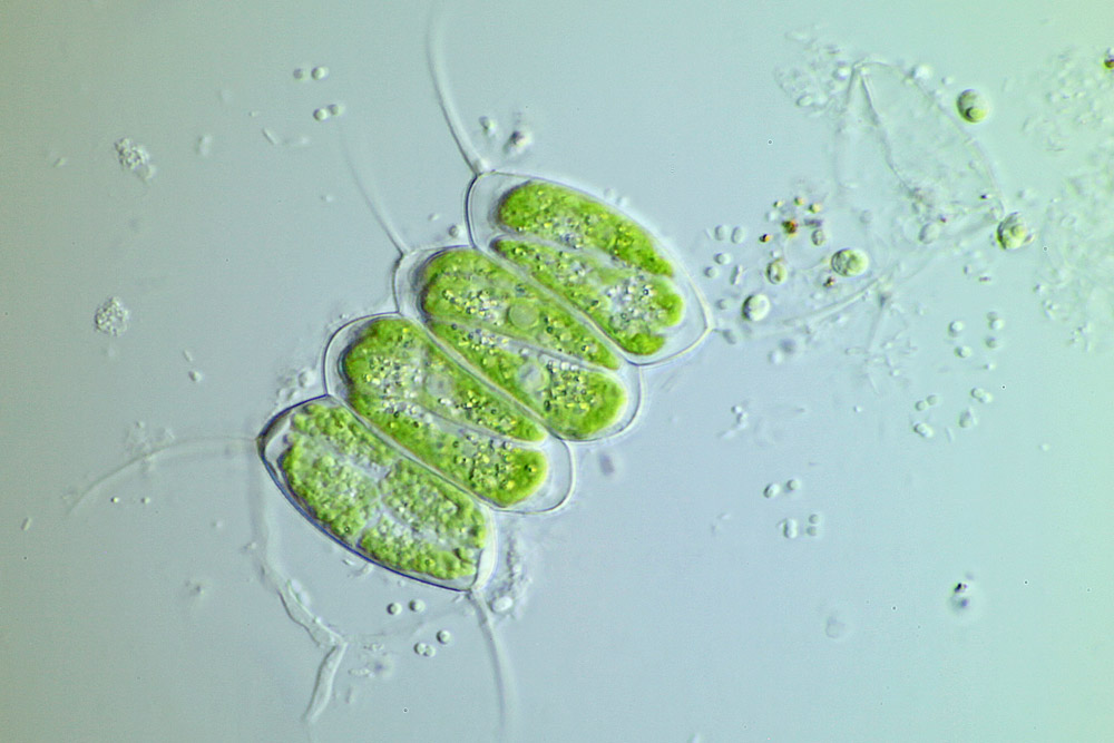 Clorofíceas unicelulares