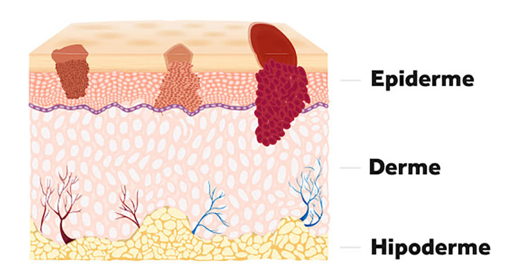 Sistema epitelial - Camadas da pele