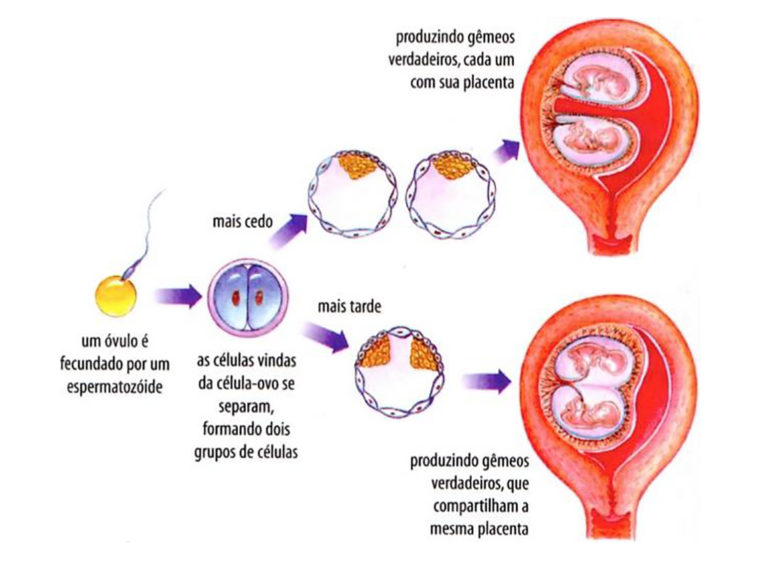 Fecundação Humana Fases Do Desenvolvimento Gravidez Gêmeos 