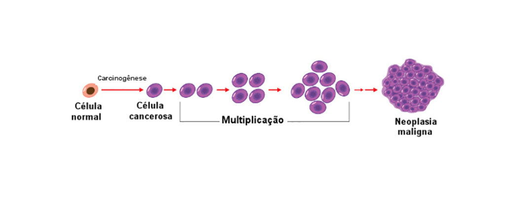 Neoplasia - Formação da neoplasia maligna