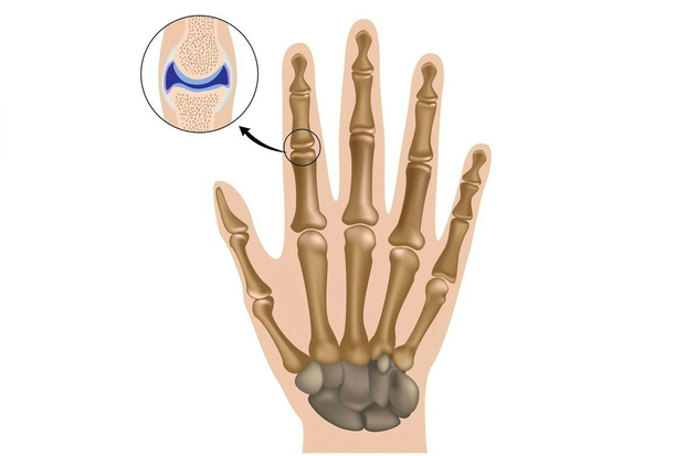 Sistema articular – Articulações das mãos